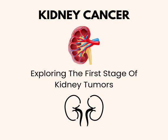 Kidney Cancer.