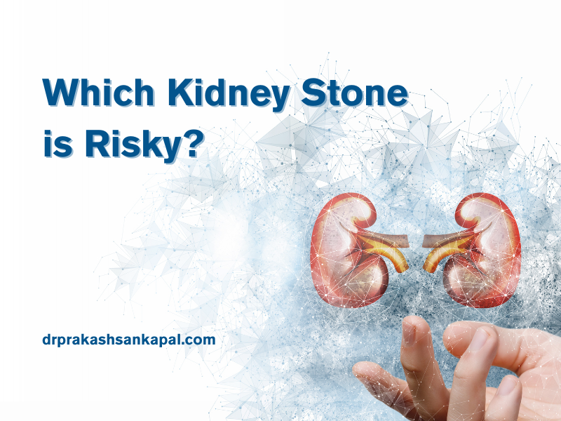 Which Kidney Stone is Risky