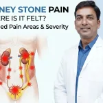 Dr Prakash Sankapal explaining kidney stone pain location from the back and side to the groin